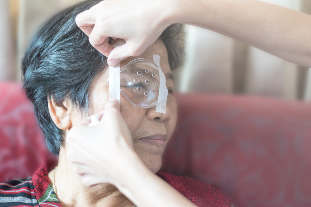 woman after catarct surgery